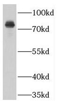 GUCY1A1 Rabbit Polyclonal Antibody