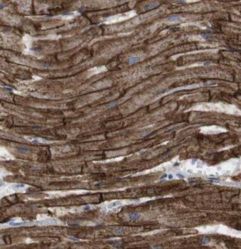 GUCY1A1 Rabbit Polyclonal Antibody