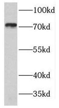 GUCY1B1 Antibody