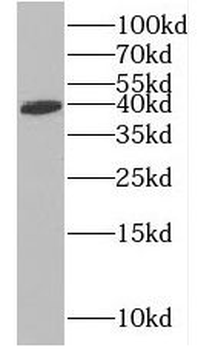 GYG1 Rabbit Polyclonal Antibody