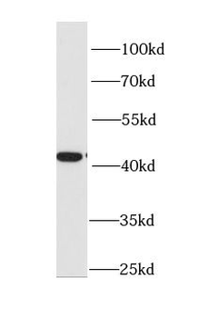HAO1 Rabbit Polyclonal Antibody