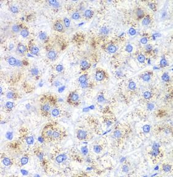 HAO1 Rabbit Polyclonal Antibody