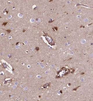 HAP1 Rabbit Polyclonal Antibody