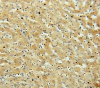 HP Rabbit Polyclonal Antibody