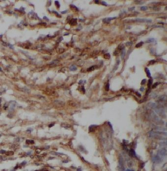 HCFC1 Rabbit Polyclonal Antibody