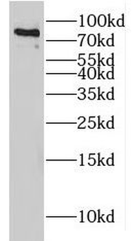 HCFC2 Rabbit Polyclonal Antibody