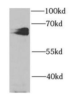 HCK Rabbit Polyclonal Antibody
