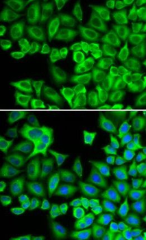 HCK Rabbit Polyclonal Antibody
