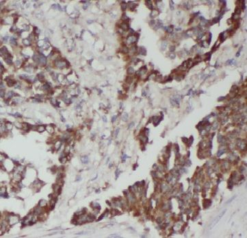 HCK Rabbit Polyclonal Antibody