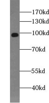 HCN2 Rabbit Polyclonal Antibody