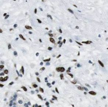 HDAC1 Rabbit Polyclonal Antibody