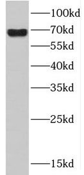 HDAC10 Rabbit Polyclonal Antibody