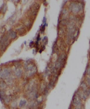 HDAC10 Rabbit Polyclonal Antibody