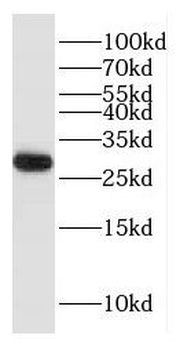HDHD3 Rabbit Polyclonal Antibody
