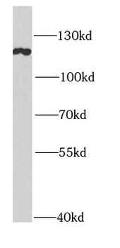 HELLS Rabbit Polyclonal Antibody