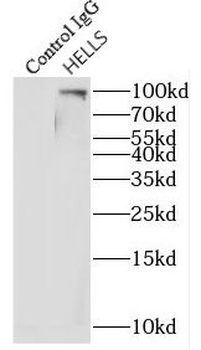 HELLS Rabbit Polyclonal Antibody