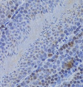 HELLS Rabbit Polyclonal Antibody