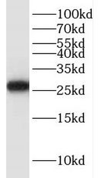 HELT Rabbit Polyclonal Antibody