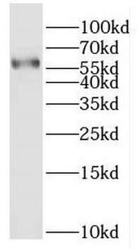 HEPACAM Rabbit Polyclonal Antibody