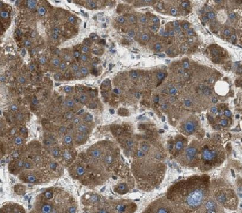 HEPACAM Rabbit Polyclonal Antibody