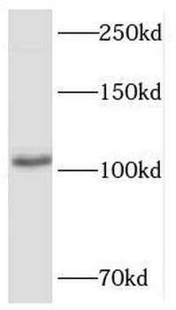 HERC4 Rabbit Polyclonal Antibody