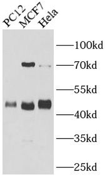 HEXIM1 Antibody