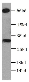 HEY1 Rabbit Polyclonal Antibody