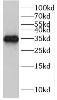 HEY2 Rabbit Polyclonal Antibody
