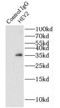 HEY2 Rabbit Polyclonal Antibody