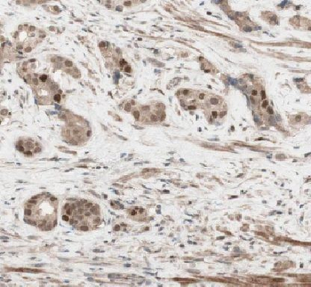 HEY2 Rabbit Polyclonal Antibody