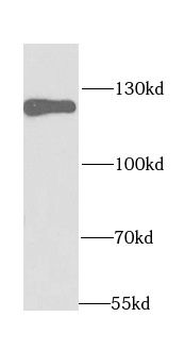HIP1 Rabbit Polyclonal Antibody
