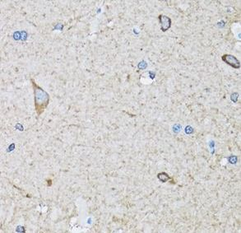 HIP1 Rabbit Polyclonal Antibody