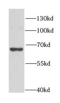 HIRIP3 Rabbit Polyclonal Antibody