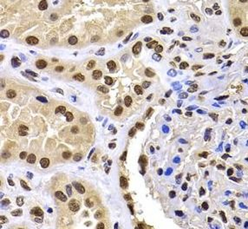 HIRIP3 Rabbit Polyclonal Antibody