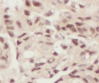 H4C1 Rabbit Polyclonal Antibody