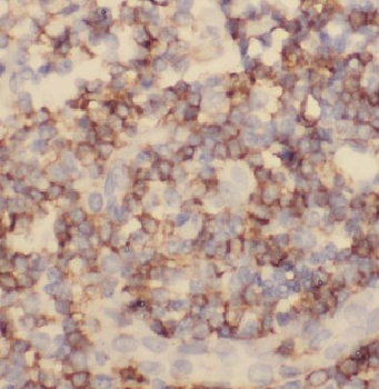 HLA DRA Rabbit Polyclonal Antibody