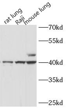 HLA-F Antibody