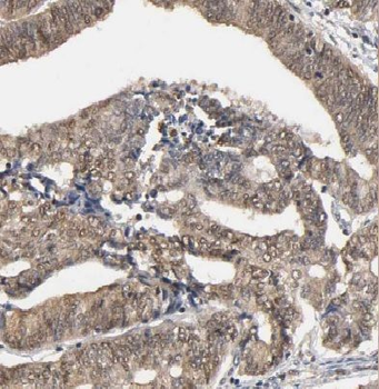 HLX Rabbit Polyclonal Antibody