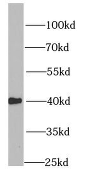 HMG20A Rabbit Polyclonal Antibody