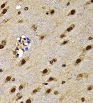 HMG20A Rabbit Polyclonal Antibody