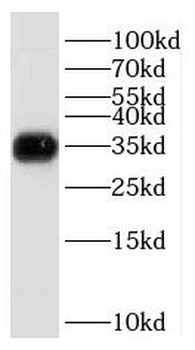 HMG20B Rabbit Polyclonal Antibody