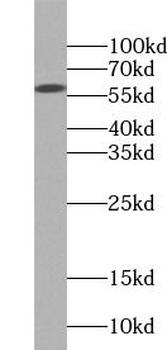 HMGCS1 Rabbit Polyclonal Antibody