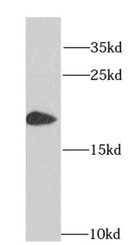HMGN1 Rabbit Polyclonal Antibody