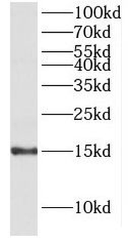 HMGN4 Rabbit Polyclonal Antibody