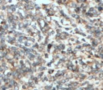 HMOX2 Rabbit Polyclonal Antibody