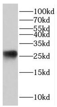 JPT1 Rabbit Polyclonal Antibody