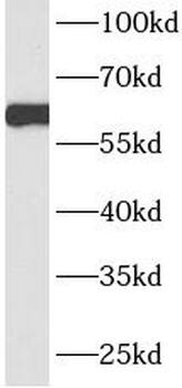 HNF1B Rabbit Polyclonal Antibody