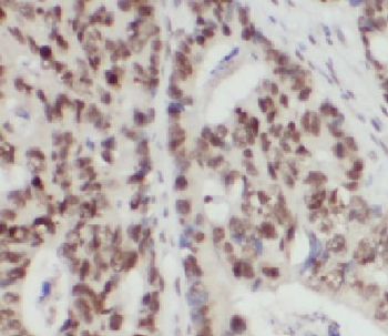 HNF1B Rabbit Polyclonal Antibody