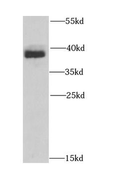 HNRNPA1 Antibody