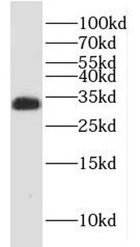 HNRNPC Antibody